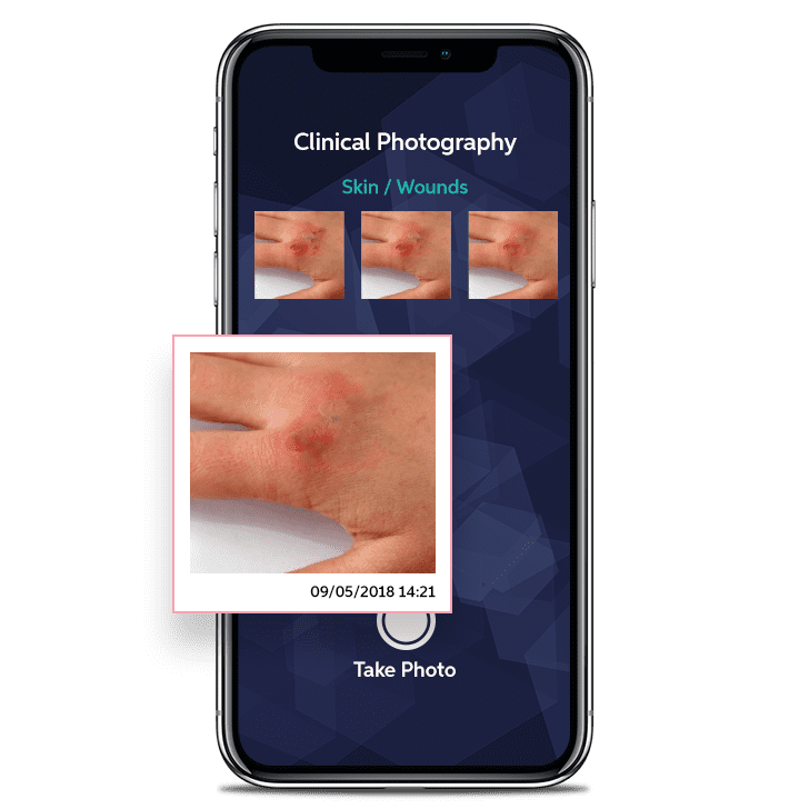 Clinical Photography Phone Screen
